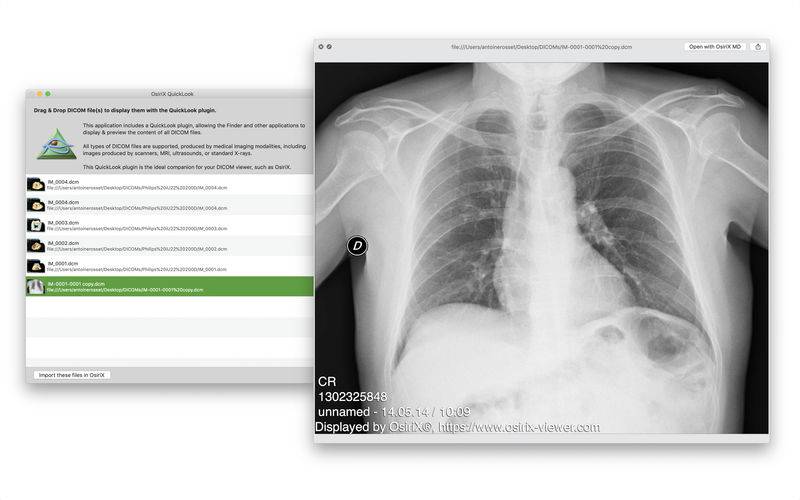 osirix dicom obelix osirix dicom obelix
